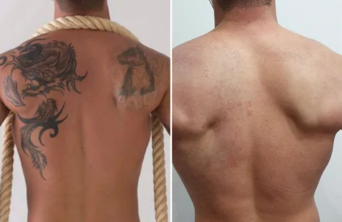 comparación 1