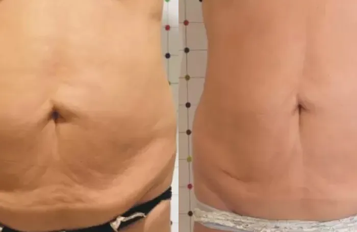 comparación 1