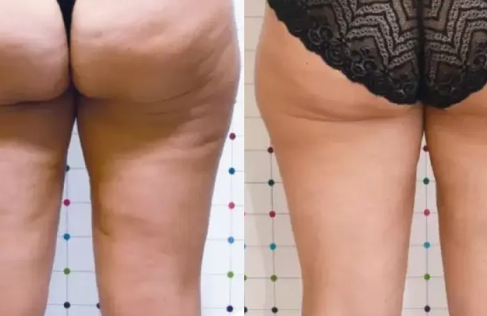 comparación 2