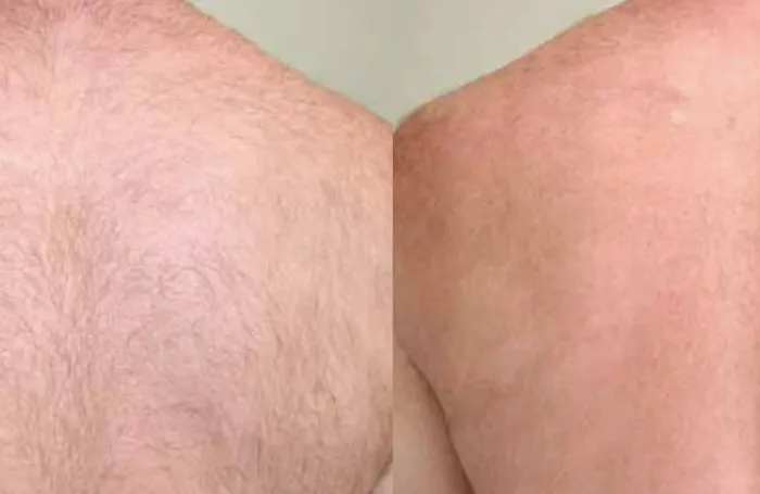 comparación 2